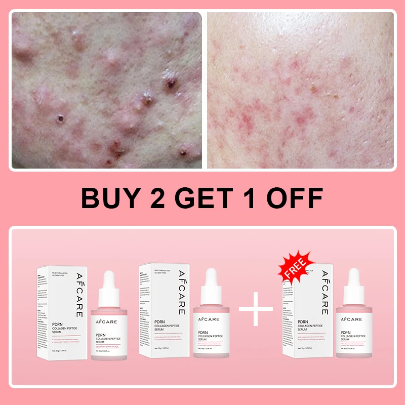 Collagen Peptide Facial Serum Targets Dull Skin Boosts Skin Elasticity Stimulates Skin Renewal Repair Salmon PDRN KOREAN Product Collagen Peptide Facial Serum Targets Dull Skin Boosts Skin Elasticity Stimulates Skin Renewal Repair Salmon PDRN KOREAN Product - Image 7