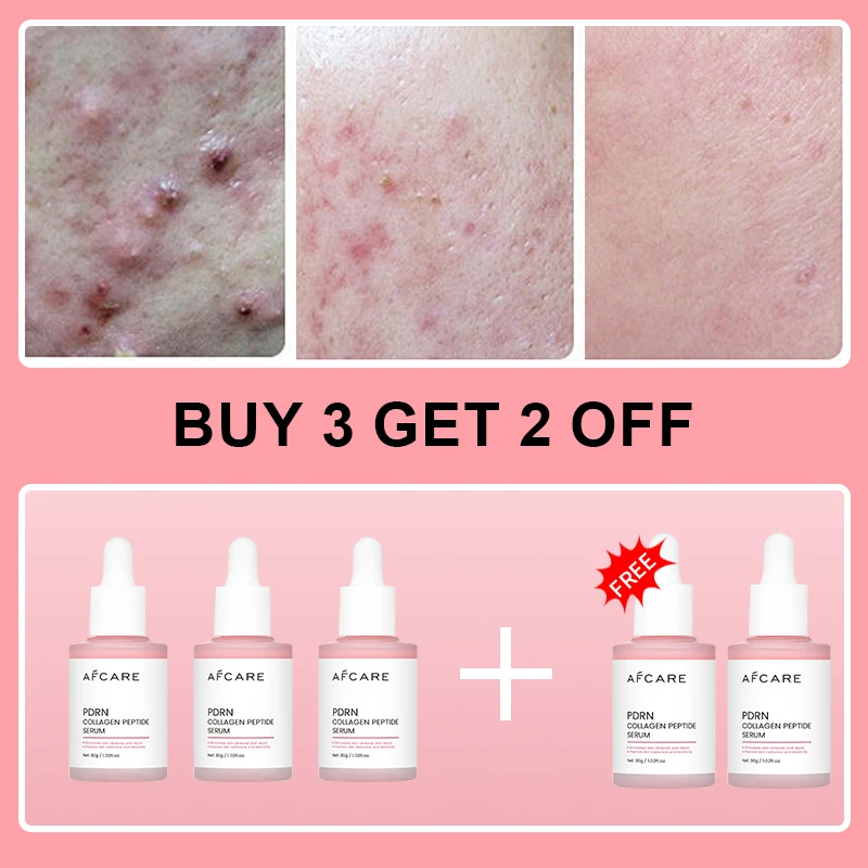 Collagen Peptide Facial Serum Targets Dull Skin Boosts Skin Elasticity Stimulates Skin Renewal Repair Salmon PDRN KOREAN Product Collagen Peptide Facial Serum Targets Dull Skin Boosts Skin Elasticity Stimulates Skin Renewal Repair Salmon PDRN KOREAN Product - Image 8