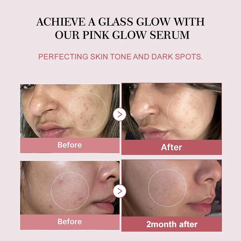 Collagen Peptide Facial Serum Targets Dull Skin Boosts Skin Elasticity Stimulates Skin Renewal Repair Salmon PDRN KOREAN Product Collagen Peptide Facial Serum Targets Dull Skin Boosts Skin Elasticity Stimulates Skin Renewal Repair Salmon PDRN KOREAN Product - Image 4